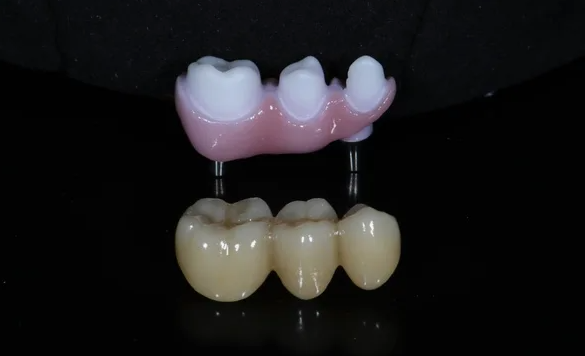 Изготовление цирконевого протеза в Стоматологии Dominanta Dental Clinic г. Краснодар ул. Чапаева 77. Запишитесь прямо сейчас! Или позвоните нам!